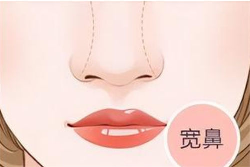 郑州她山医美技术稳准狠？修复能力超强，术后结果自然持久，真实术例解析！