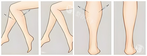 上海美莱袁玉坤医生吸脂口碑如何？大腿腰腹+面部抽脂术例多，技术超靠谱！​