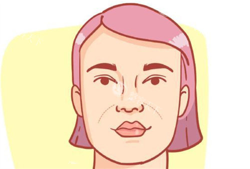 法令纹图片