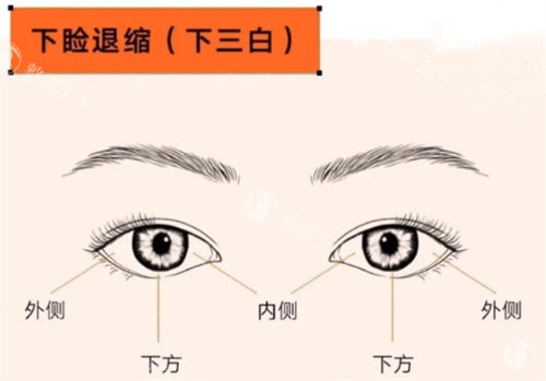 北京美憬整形外科怎么样？眼修复＋鼻修复＋小切口拉皮术例展示与价格详情