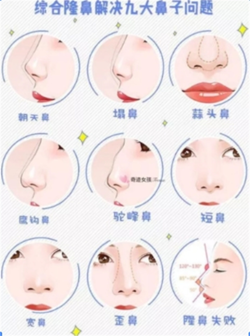 长春孙轶峰医生怎么样？擅长做鼻子和吸脂 是医美技术比较靠谱的一位医生！