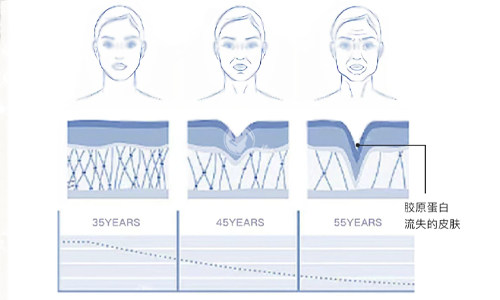 胶原蛋白流失的皮肤