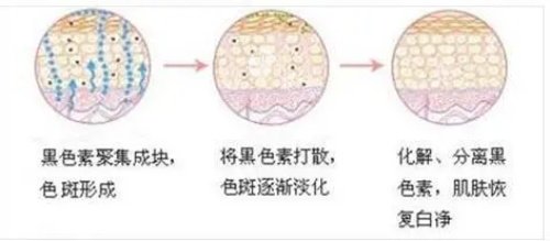 北京空军总医院美容激光中心价格表！激光祛斑 2800 起 / 脱毛 1200 起，正规医院收费标准公开