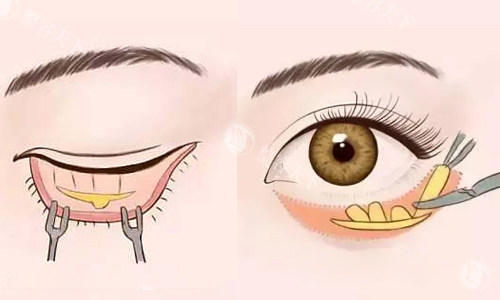 健丽医美去眼袋地址在哪里？公布国内健丽整形十五家分店详细地址及出行路线等