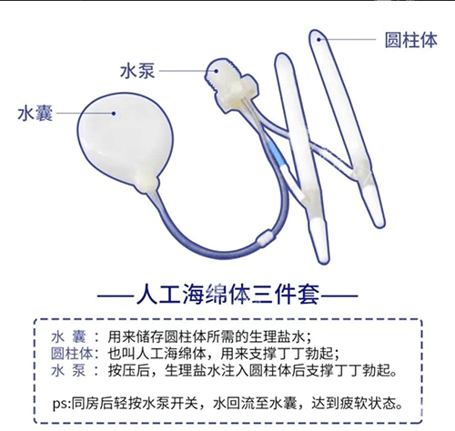 人工海绵体三件套