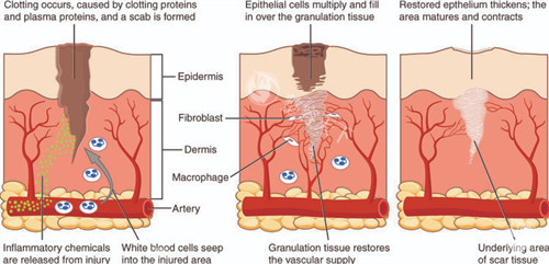 改善皮肤色素疤痕