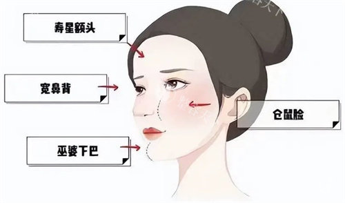 【真人分享】馒化脸修复真实体验：小创口技术 + 术后护理指导，改善比较快！