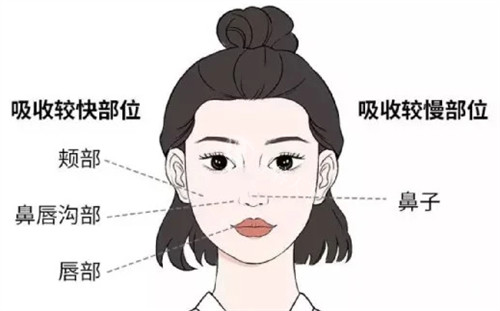 【细节】白振华馒化脸修复过程：术前面诊细致 + 术后随访，修复结果超预期！