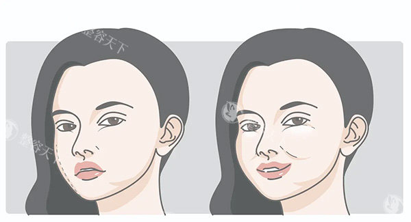 成都馒化脸修复哪家好?银海/新丽美/初龄,口碑技术都很不错