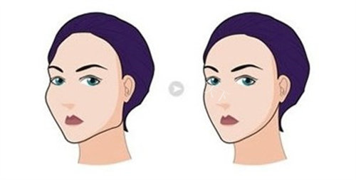 惊艳！景熙翔磨骨自然精致风格，让你轻松拥有明星同款小 V 脸！