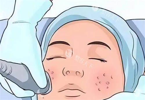 想知道美莱整形医院黄金微针做一次多少钱？1000~3000元/次，医院背景/价格详情/口碑揭秘！