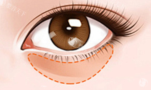 常州谢院美袋整形 2025 价格表公布：去眼袋1800 元起、双眼皮3000 元起、面部提升6000 元起