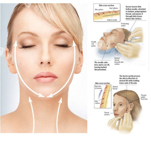 沈阳杏林整形医院面部提升技术好吗？崔昌墉、刘建波、张宇夫三位医生擅长面部抗衰