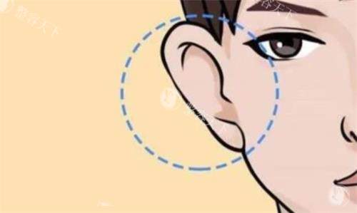 我国小耳畸形报销政策解读，报销比例/申请流程/机构选择指南