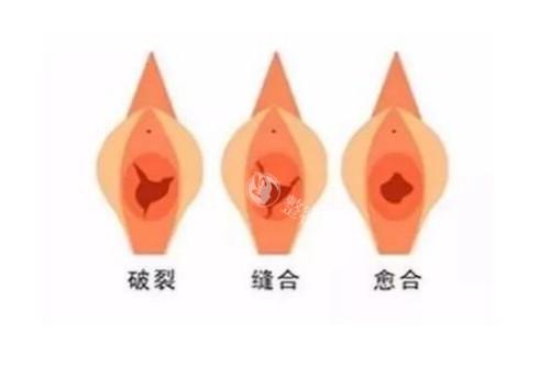 私密整形治疗图片展示