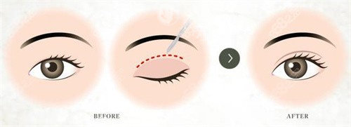 成都高新唯美星辰医疗美容怎么样，环境舒适项目全医生审美在线做整形放心！