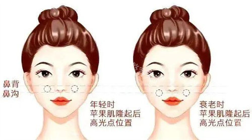 田浩祥医生微整技术怎么样，可3D模拟注射方案/做幼态脸轮廓固定出色口碑超棒！