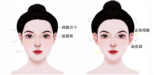 幼态脸主要做的项目