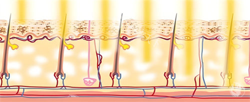 光子嫩肤作用图