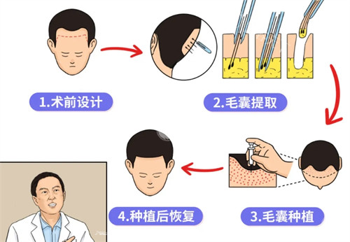 南京森海植发医院怎么样？这有医院简介|植发技术|收费标准|发友口碑等介绍