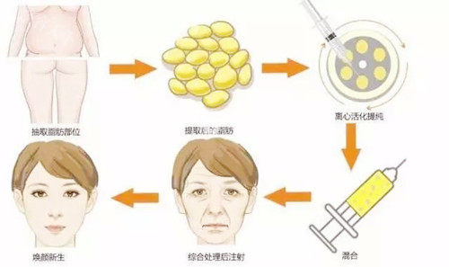 石家庄俏佳人医疗美容是正规的医美医院吗？答案：确实是正规军，有证有实力！