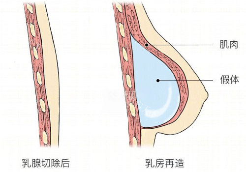 成都现代刘黎明医生个人简历介绍？含缩胸等项目价格，整形参考清晰