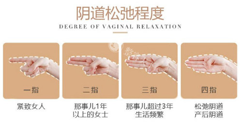 阴道松弛程度图示