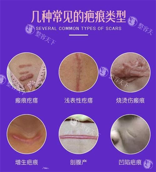 网评南京正规疤痕修复医院排名榜：施尔美整形/米兰柏羽整形/连天美美容医院祛疤口碑好！