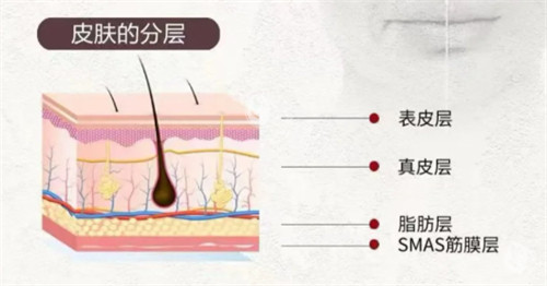 softwave索夫波适用皮肤层次