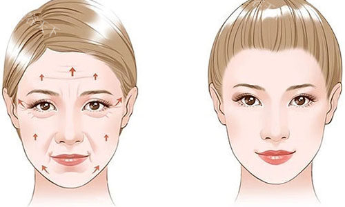 拉皮手术价格差异高达10倍？深度剖析费用构成要素，教你合理规划预算！