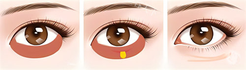 襄阳合美医疗美容医生名单:专项团队_擅美鼻填充/祛眼袋_逆龄术操作_预约中~