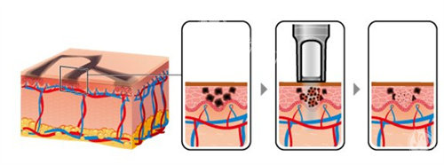 鞍山皮秒祛斑医院大比拼！探店实拍+医生技术测评，帮你找到更靠谱的那家！