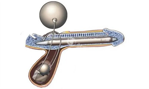 韩国世檀塔男科医院真实就诊体验！项目价格表全公开，看完再决定去不去！
