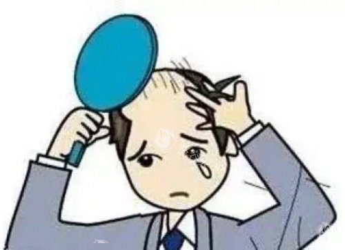 头发秃顶示意图