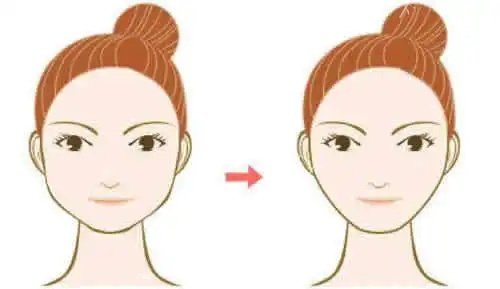 揭秘张笑天医生下颌角手术优势，风格自然，消肿快，让你拥有精致脸型！