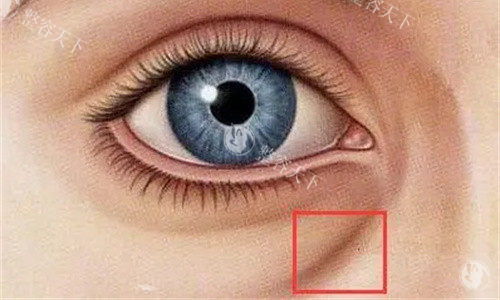 28岁小姐姐注射艾莉薇凝采后：泪沟消失，素颜也敢直面原相机