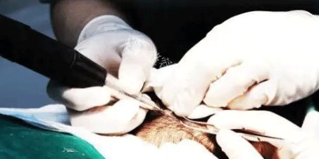 徐州植发医院排名前三测评：医科汇3大技术+予美高性价比+星晨背景加持，这三家值得跑一趟！