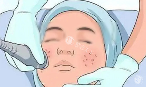 想知道美版超声提拉多少钱一次？影响价格的因素大揭秘，带你了解真实行情！