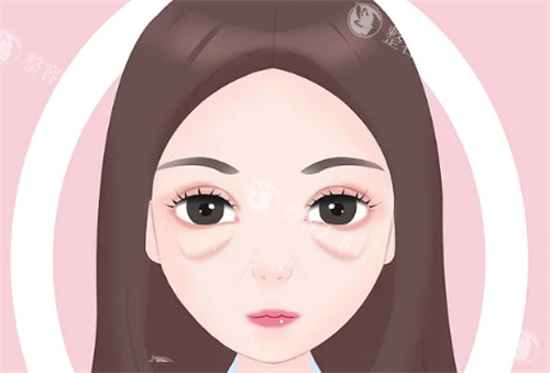 眼袋泪沟太重别发愁！多种医美方法助你重焕眼部青春光彩