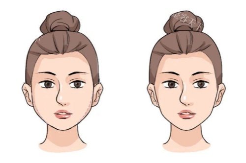 脸部馒化怎么才能变薄？揭秘有效改善脸部馒化问题让脸蛋变精致的实用方法