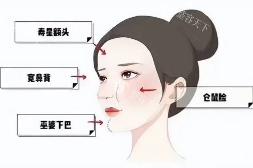 苹果肌馒化太显肿？懂得这些方法，让你的苹果肌轻松实现轻薄感，美貌直线up！