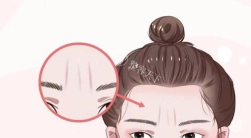 纠结川字纹该打玻尿酸还是改善皱纹？看完这篇超全解析，让你轻松做出适合自己的选择！