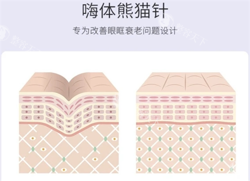 嗨体熊猫针皮肤组织动画展示