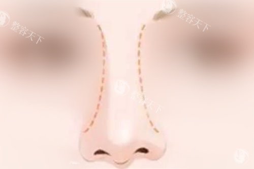 鼻部形态曲线展示图