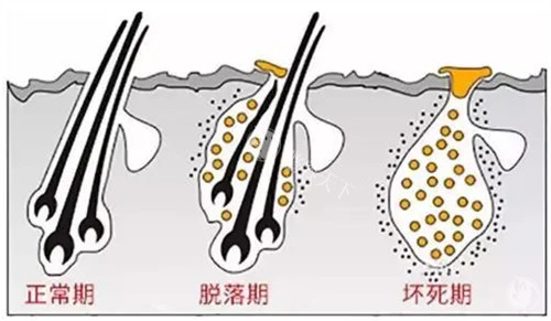 头发生长周期图解