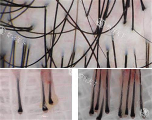 青逸植发有多少间连锁店？在国内分布8个城市设有12家直营分院~！