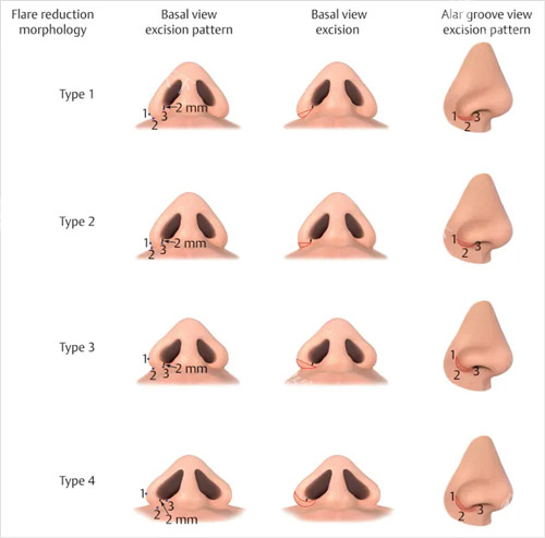 想做阳江希腊鼻？哪家医院靠谱不踩雷？看资质/医生/术后反馈！2025值得信赖机构盘点，含预约及价格参考！