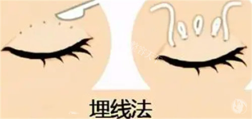 李欣豫双眼皮医生预约挂号全攻略：官网、第三方平台及面诊流程详解！