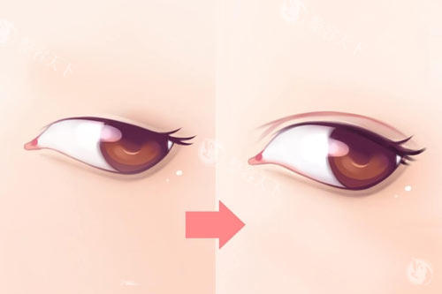 沈阳友谊整形医院超靠谱！综合医美实力强，轮廓整形、脂肪填充结果自然，口碑扎实