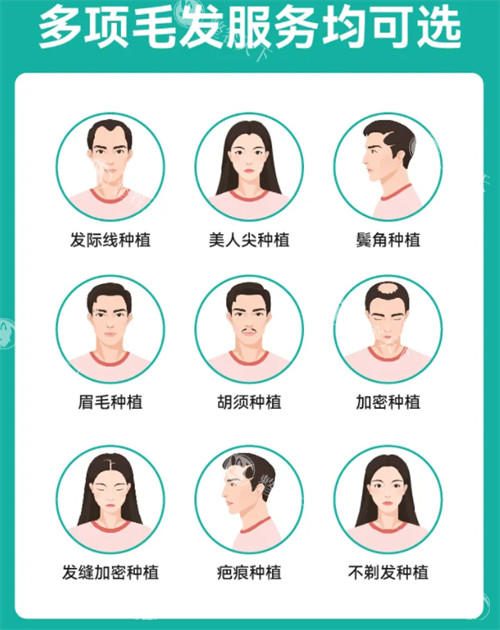 临沂真程植发怎么样？兰山老牌植发机构|12年技术沉淀|发际线种植口碑爆棚